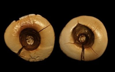 Le più antiche otturazioni dentali scoperte in Italia