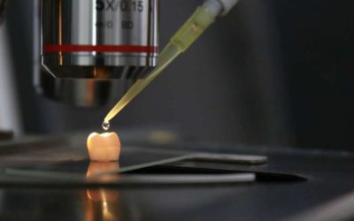 Un gel per rigenerare lo smalto dentale